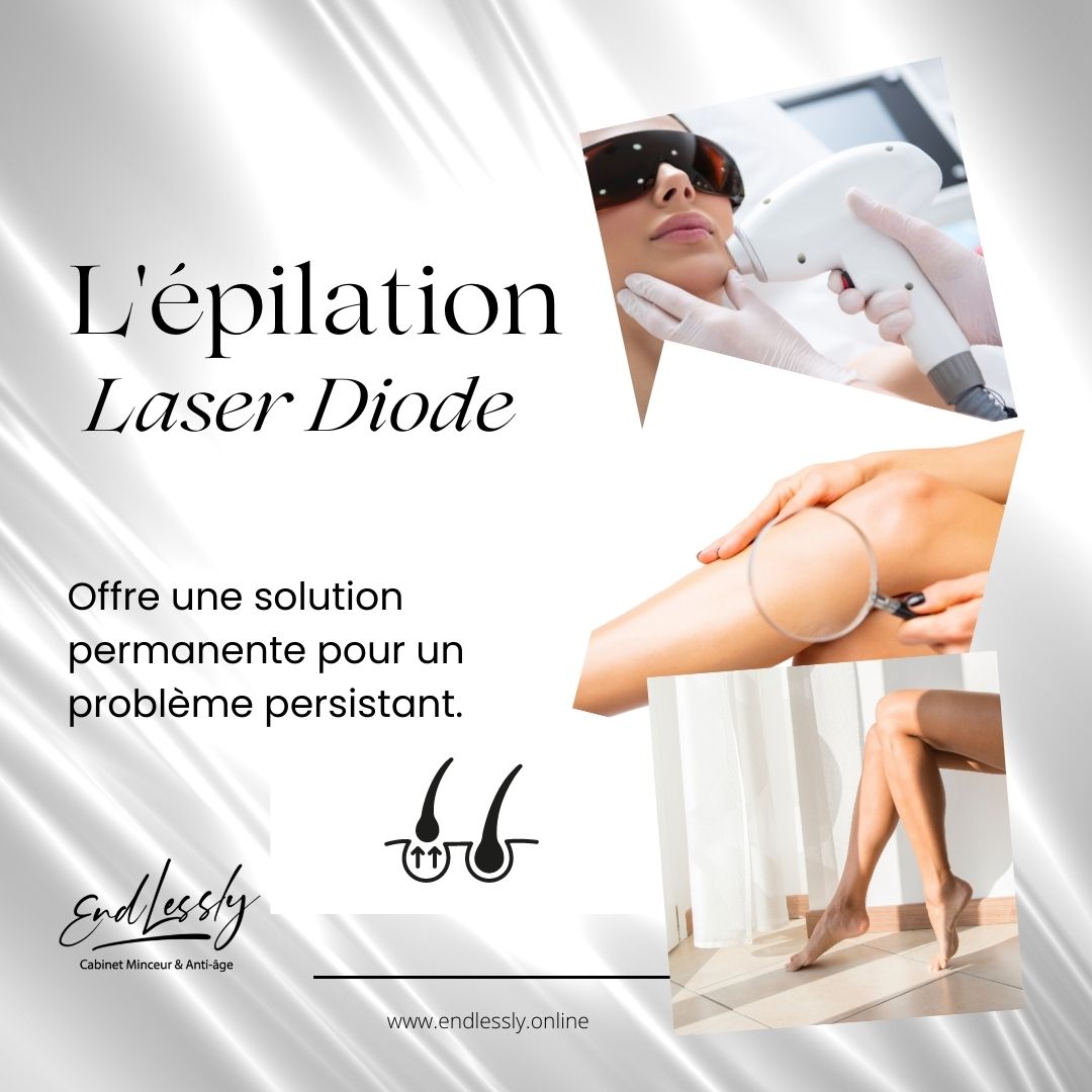 épilation laser diode