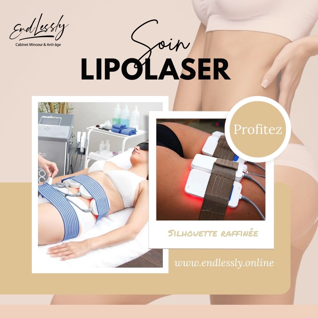 lipolaser